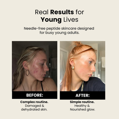 PDRN Brightening Serum