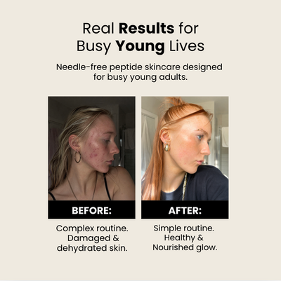 PDRN Brightening Serum