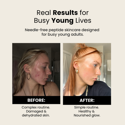 PDRN Brightening Serum